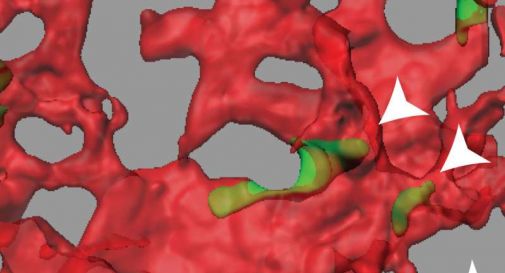 proteina TRPM7