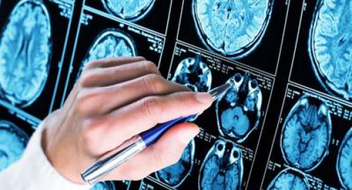 Iss, scoperto meccanismo chiave Alzheimer, speranza per diagnosi e cure.